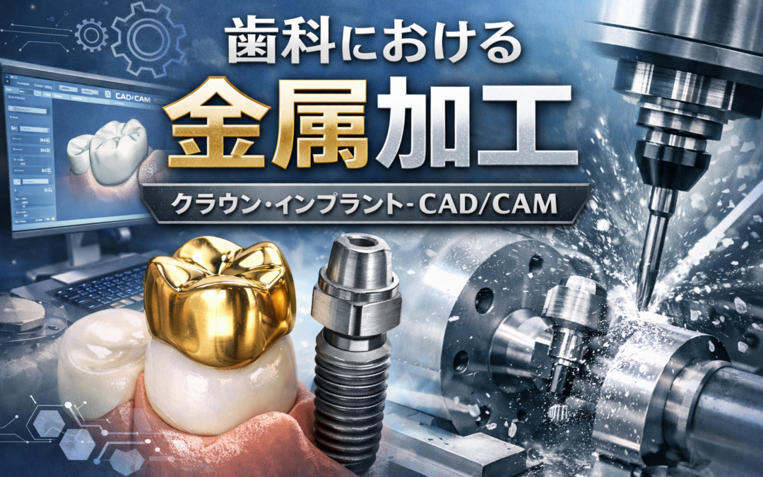 歯科分野における金属加工技術とは？